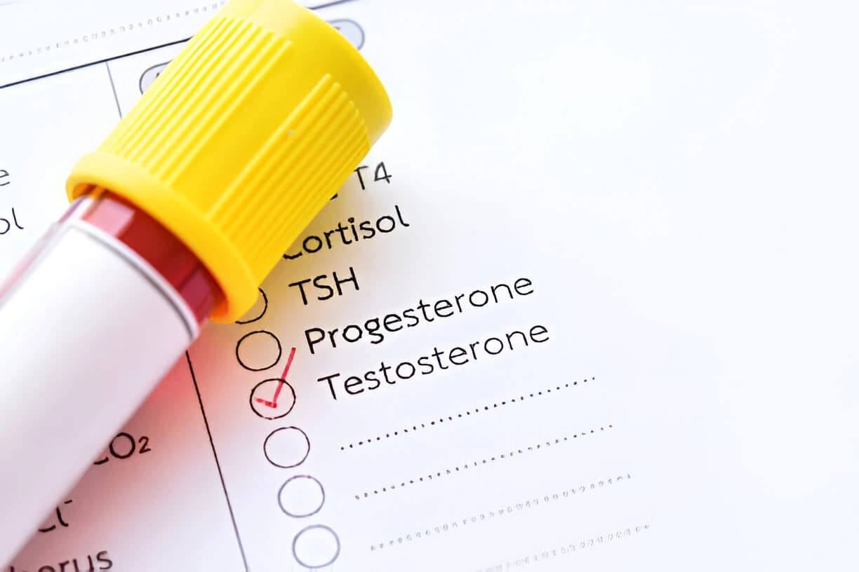 Hormonal test tube with checklist
